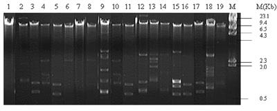 Characterization and Bio-Typing of Multidrug Resistance Plasmids From Uropathogenic Escherichia coli Isolated From Clinical Setting